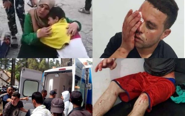 مواجهات دامية بإساكن تخلف إصابات خطيرة