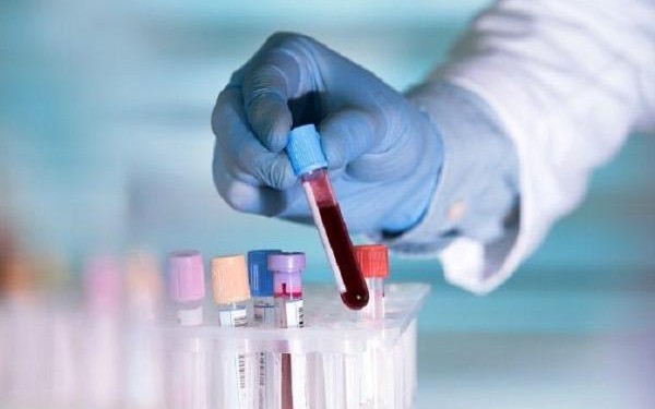 انطلاق أكبر تجربة اختبار دم لخمسين نوعا من السرطان