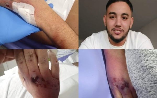 مطالب بفتح تحقيق في وفاة شاب مغربي بمخفر للشرطة ببلجيكا