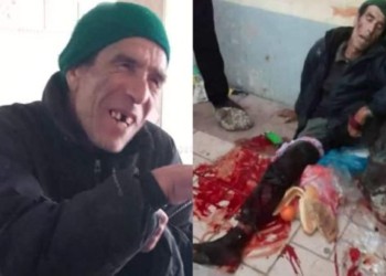 تذمر واسع بترجيست بعد الاعتداء على مختل عقليا بسكين