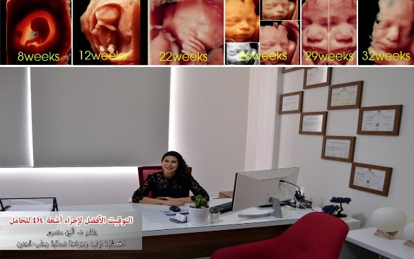 التوقيت الأفضل لإجراء أشعة D4 للحامل