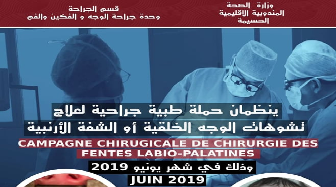 حملة طبية جراحية لعلاج تشوهات الوجه الخلقية بالمستشفى الإقليمي بالحسيمة