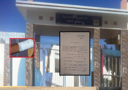 "التشرميل" يصل لداخل إعدادية سيدي عابد بالحسيمة والاساتذة يحتجون