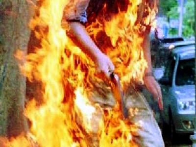 وفاة شاب من تماسينت نواحي الحسيمة متأثرا بحروقه