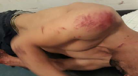 اعتقال شخص باساكن اعتدى بالضرب والجرح على تاجرين