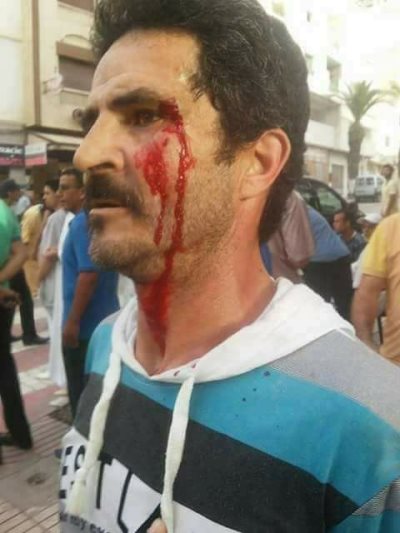 النهج الديمقراطي بالحسيمة: " يدين القمع الهمجي لأبناء شعبنا بالريف"