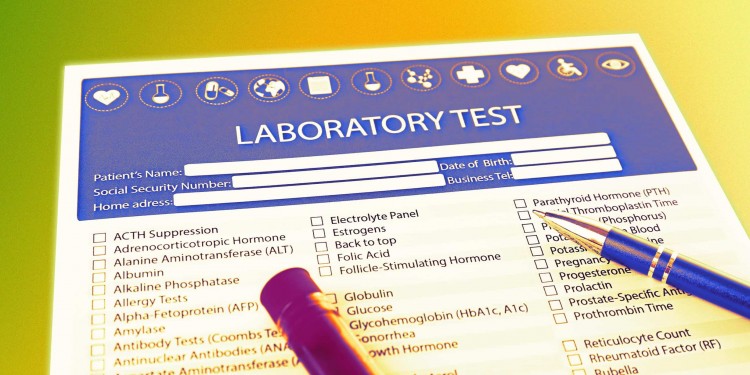 إيقاف تعويضات التحاليل الجاهزة