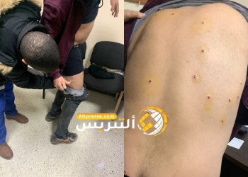 مواجهات دامية بجماعة كتامة تسفر عن إصابات