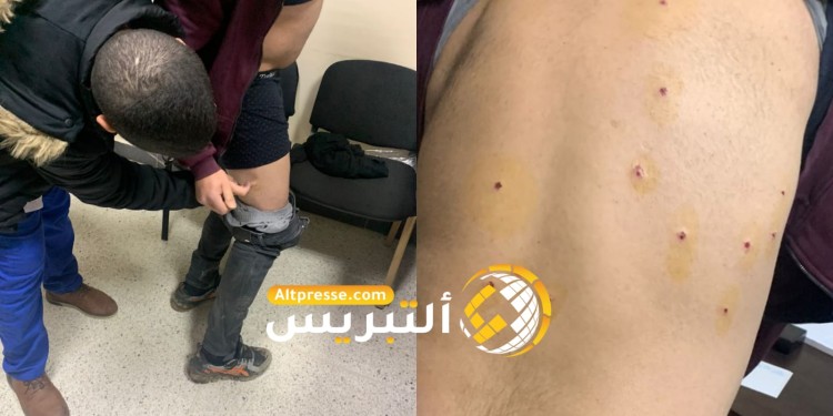 مواجهات دامية بجماعة كتامة تسفر عن إصابات